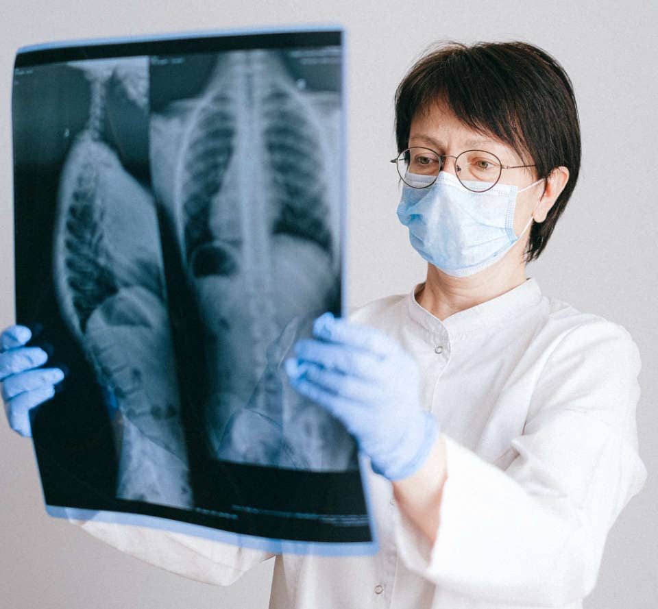 Doktor hält Röntgenaufnahmen